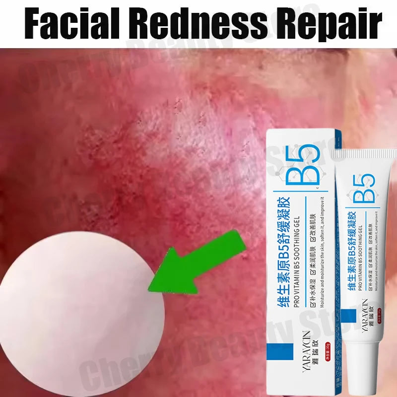 Day Facial Redness & Repair Cream – Soothing & Hydrating Treatment