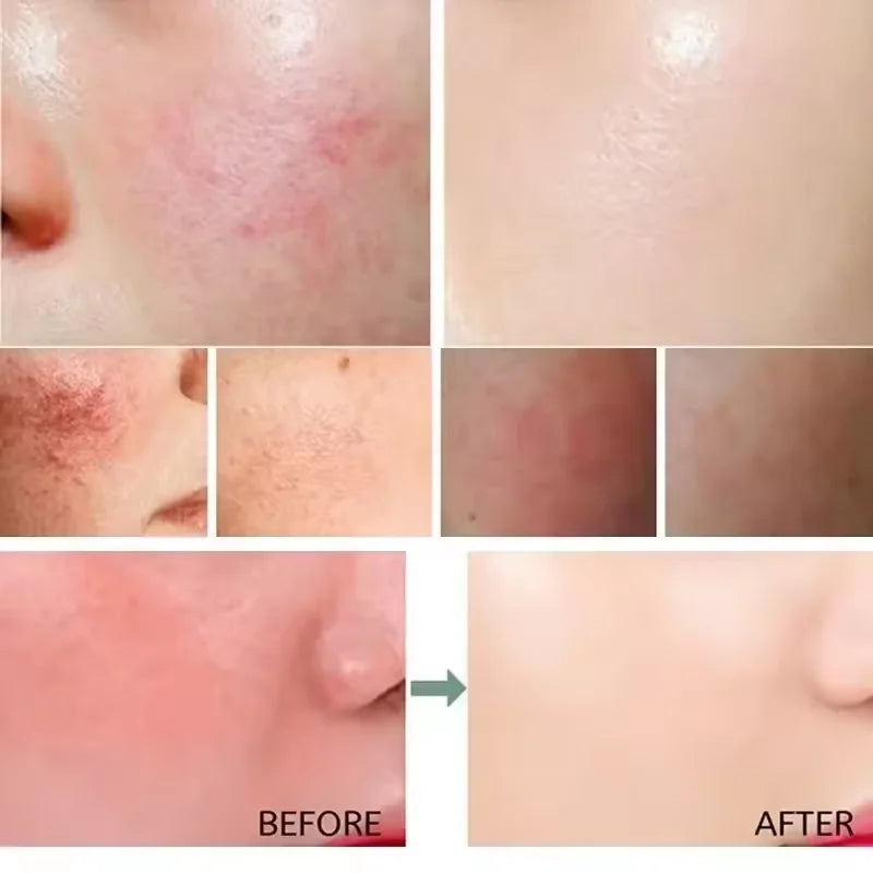 Day Facial Redness & Repair Cream – Soothing & Hydrating Treatment