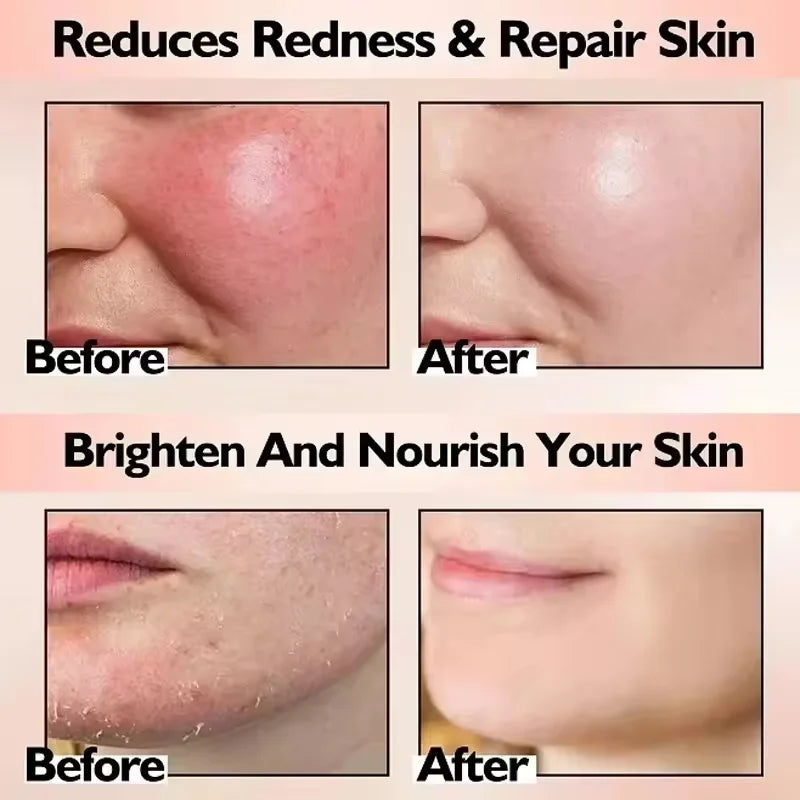 Day Facial Redness & Repair Cream – Soothing & Hydrating Treatment