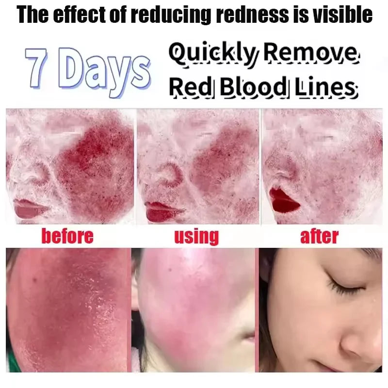 Day Facial Redness & Repair Cream – Soothing & Hydrating Treatment
