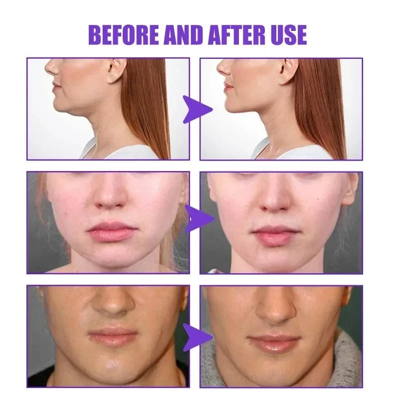 Jaysuing V Face Firming Cream – 30 ml